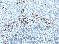 Kappa Light Chain Antibody (Kap-56), Novus Biologicals 0.2mg; Unlabeled:Antibodies,